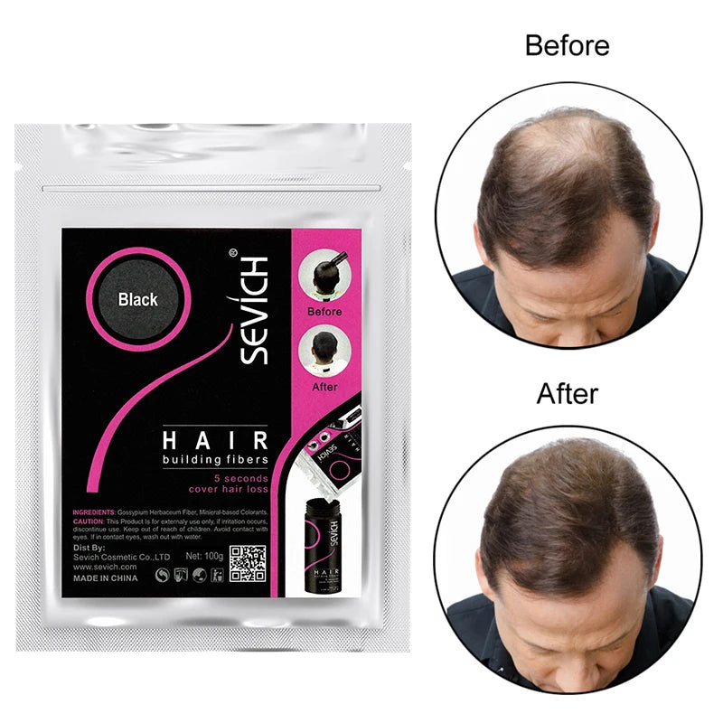 Sevich 100g Hair Fibers Refill Bag. Hair Growth Powder