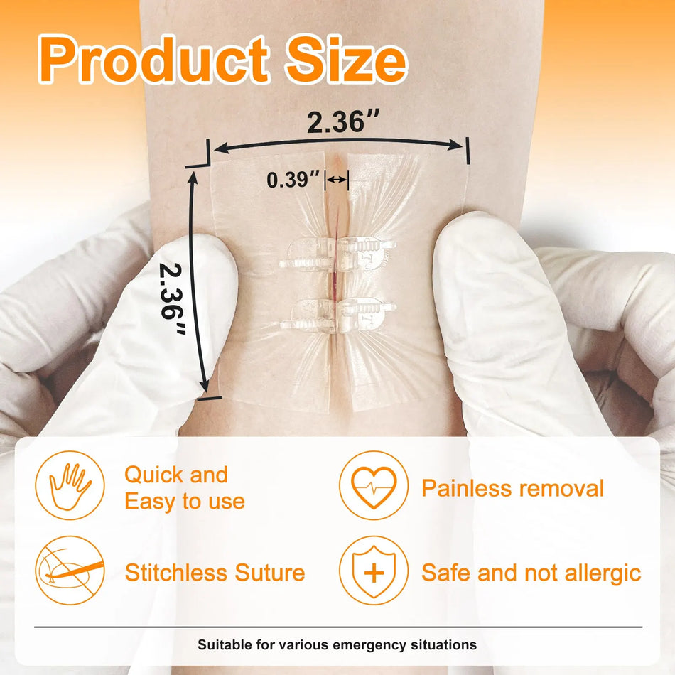 CARBOU 2PCS Zipper Painless Wound Closure Device Suture-free Wound Dressing Closure Strips Kit Emergency Laceration Closures